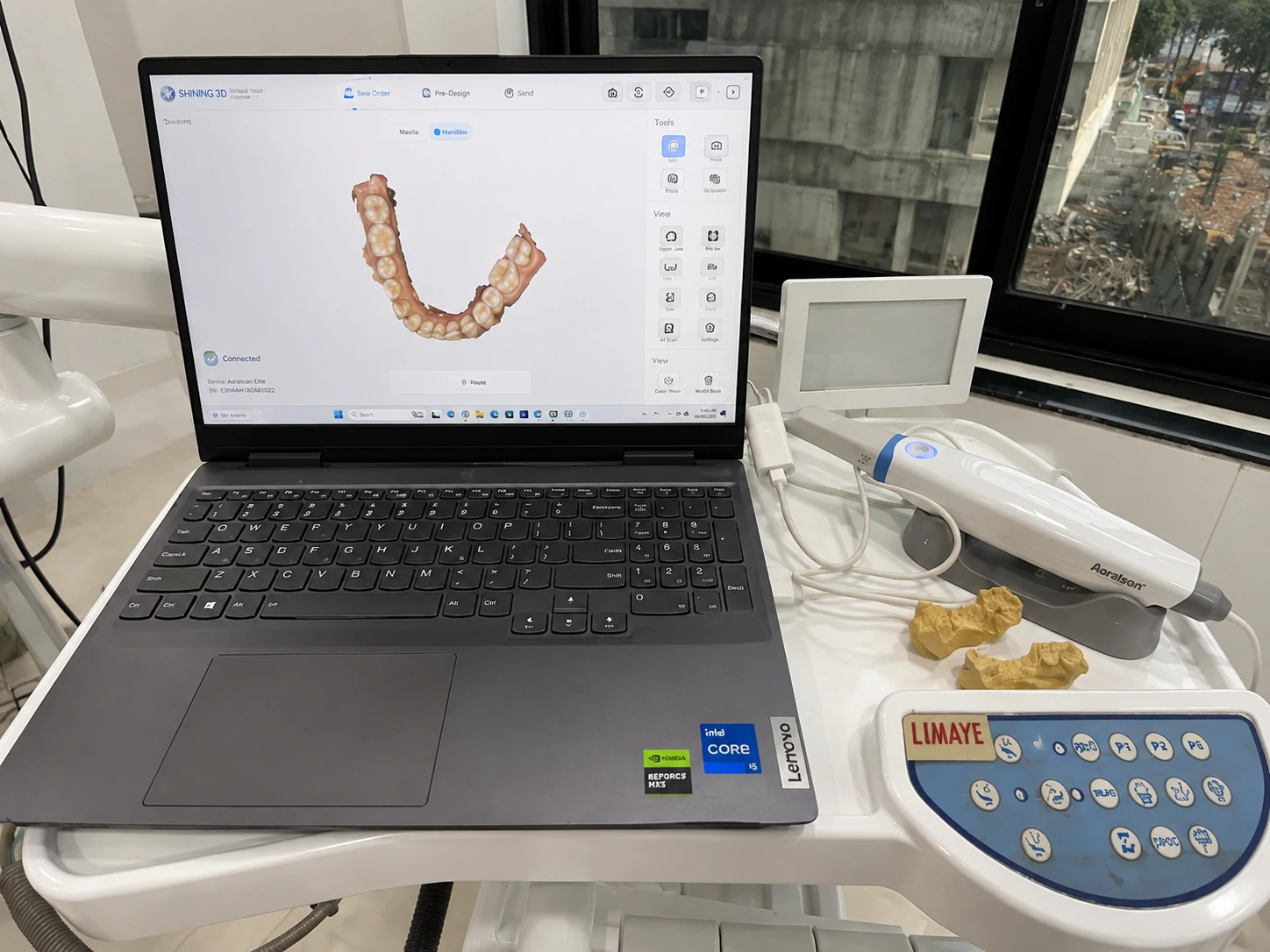 Digital intraoral scanning equipment